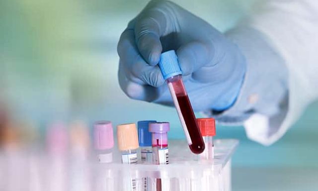 ΜΠΟΓΔΑΝΟΣ ΔΙΟΝΥΣΙΟΣ – ΑΙΜΑΤΟΛΟΓΟΣ – ΚΕΡΚΥΡΑ