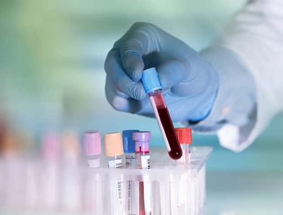 ΜΠΟΓΔΑΝΟΣ ΔΙΟΝΥΣΙΟΣ – ΑΙΜΑΤΟΛΟΓΟΣ – ΚΕΡΚΥΡΑ